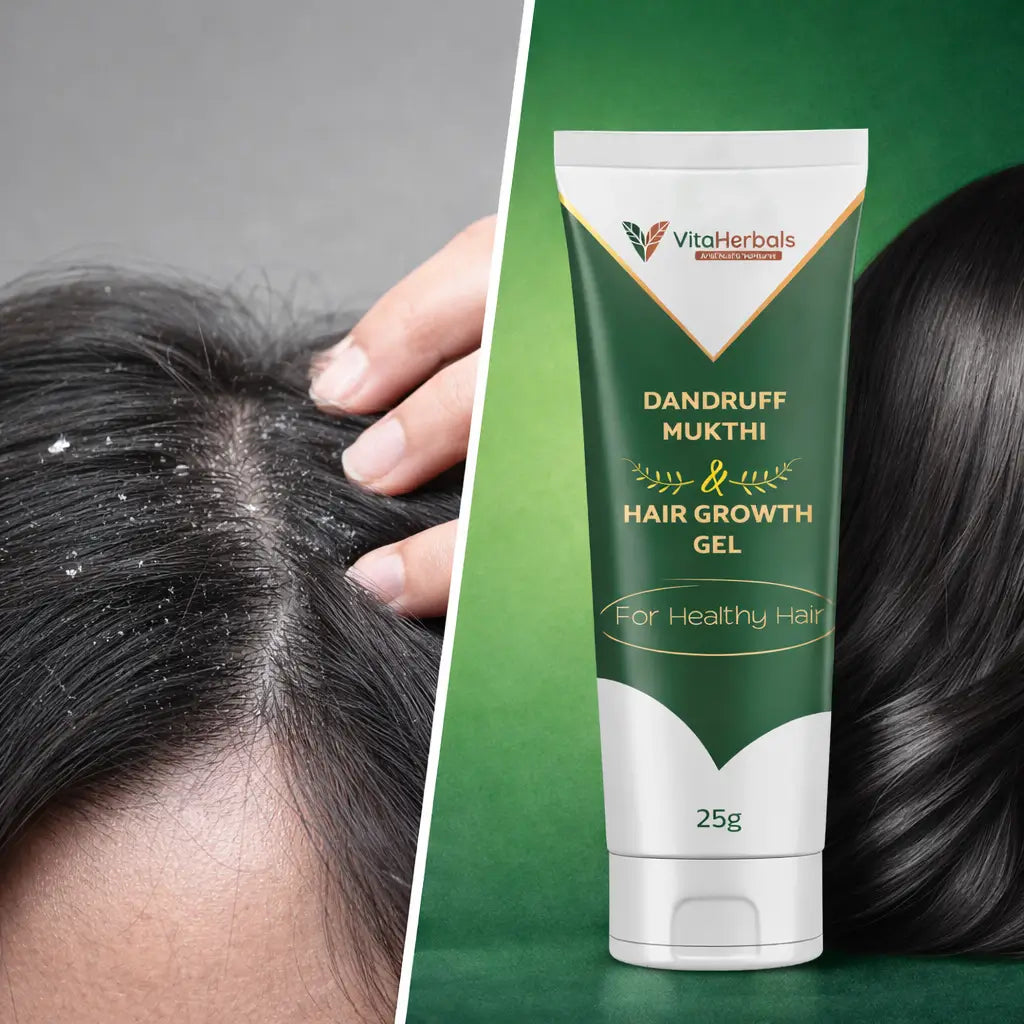 Dandruff Mukthi Gel